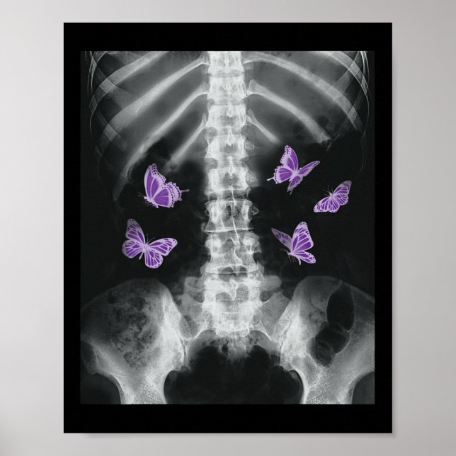 Affiche Egirl Xray Squelette rose Papillon Harajuku Y2k Da (Devant)