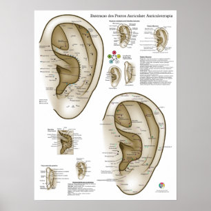 Affiche Graphique d'Acupuncture de l'Oreille Espagnol