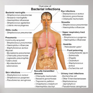 Affiche Graphique des principales infections bactériennes