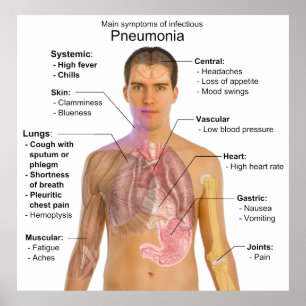 Affiche Graphique des symptômes de la pneumonie