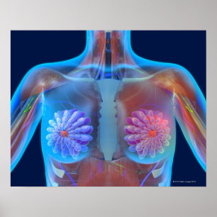 Affiche Illustration d'ordinateur représentant le cancer