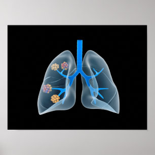 Affiche Image Conceptuelle Du Coeur Humain 4