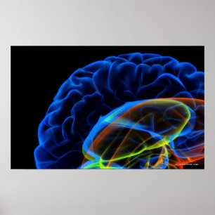 Affiche Image de rayon X du cerveau