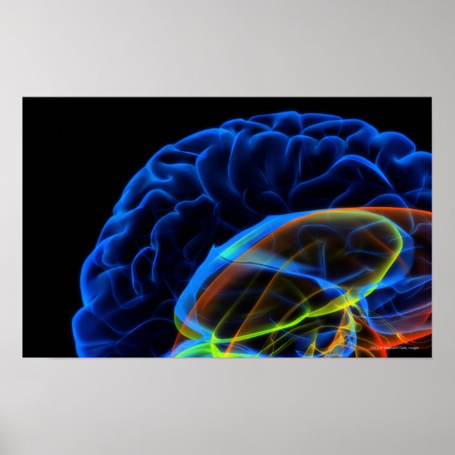 Affiche Image par rayons X du cerveau (Devant)