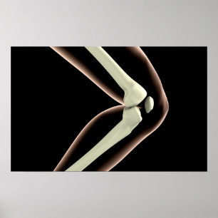 Affiche Image X-Ray Du Genou 1