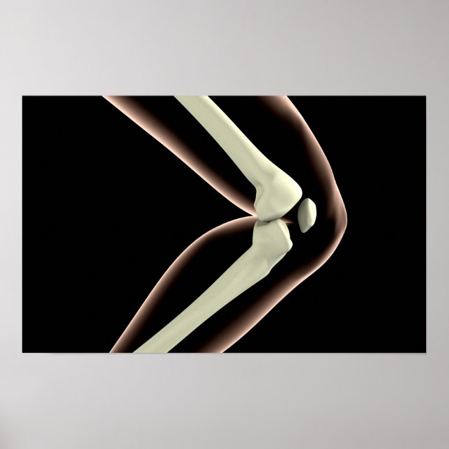 Affiche Image X-Ray Du Genou 1 (Devant)