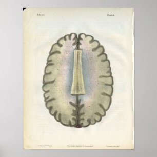 Affiche Imprimer l'anatomie du cerveau humain