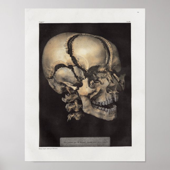 Affiche Imprimer l'anatomie Vintage du crâne humain 1867 (Devant)
