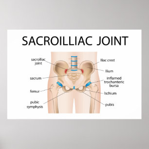 Affiche Joint Sacroilliac