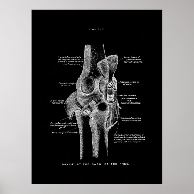 Affiche Joints genou Anatomie Art (Devant)