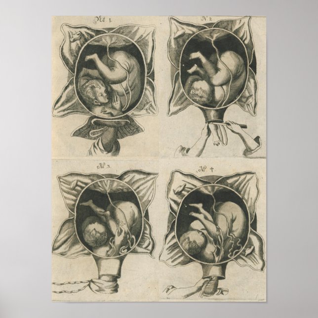 Affiche Justine Siegemund Cour - Grossesse de naissance d' (Devant)