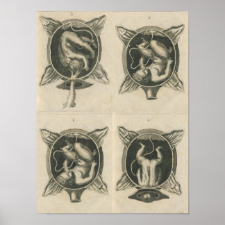 Affiche Justine Siegemund Cour sage-femme accouchement acc