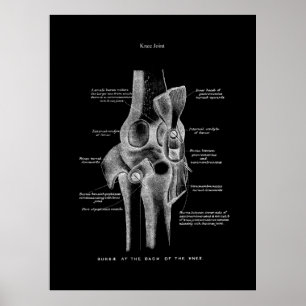 Affiche Knee Joints Anatomy Art