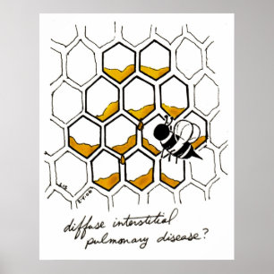 Affiche La maladie pulmonaire interstitielle diffuse