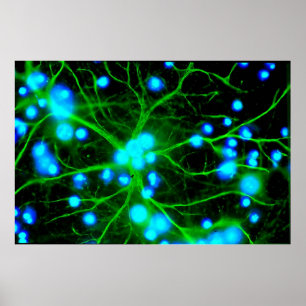 Affiche Les Astrocytes sont des cellules globulaires en fo