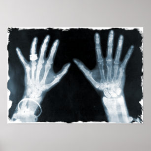 Affiche Mains et bijoux en squelette X-Ray - bleu