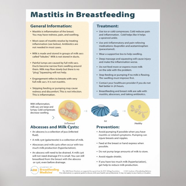 Affiche Mastitis dans l'affiche d'allaitement (anglais) (Devant)