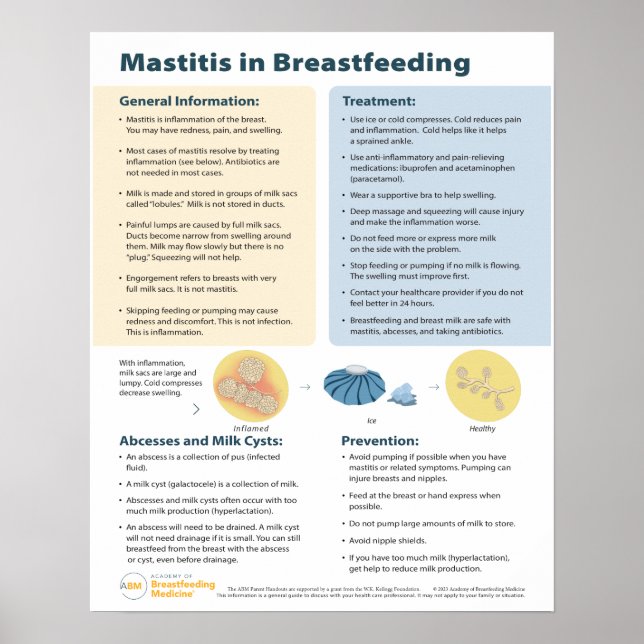 Affiche Mastitis dans l'affiche d'allaitement (anglais) (Devant)