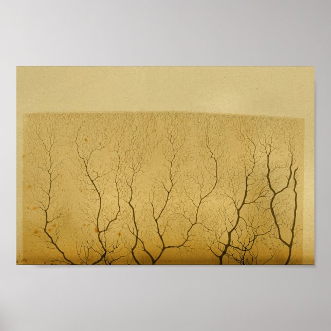 Affiche Nerfs vintages du système nerveux central 1886 (Devant)