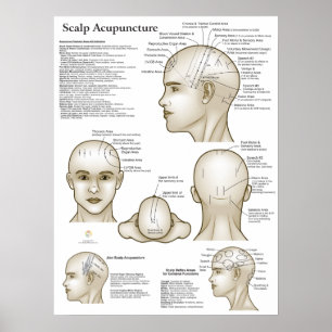 Affiche Points d'acupuncture du cuir chevelu