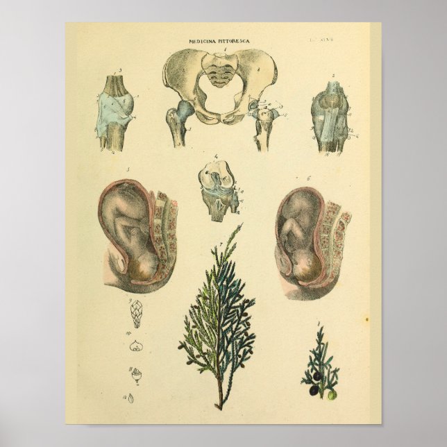 Affiche Position foetale Pelvis Anatomie Art Vintage Impri (Devant)