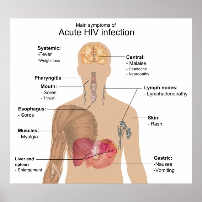 Affiche Principaux symptômes de l'infection aiguë par le V (Devant)