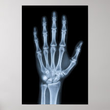 Radiographie clinique de la main
