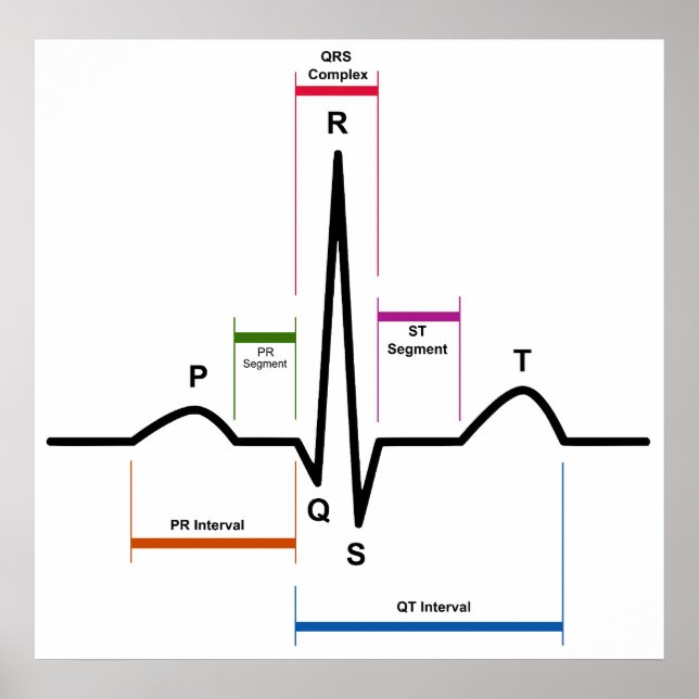 Affiche Rythme sinus dans un diagramme ECG d'électrocardio (Devant)