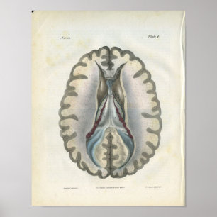 Affiche Section Cerveau humain Anatomie Vintage Imprimer