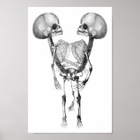 Siamese joint Twins Anatomy Skeletons art
