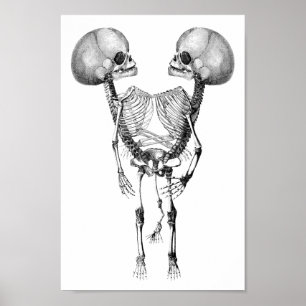 Affiche Siamese joint Twins Anatomy Skeletons art