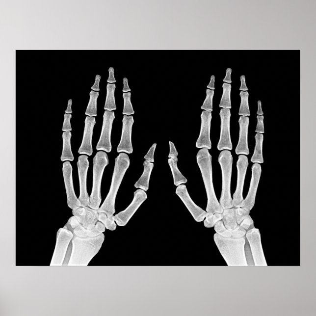 Affiche Skeleton Hands Xray Photo Anatomie humaine photo (Devant)