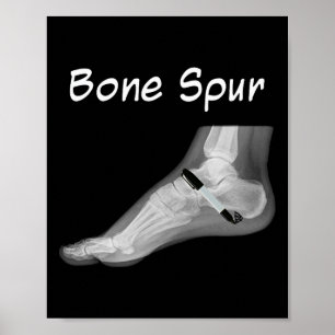 Affiche Stylo à encre Trump Bone Spur Drôle Anti Trump