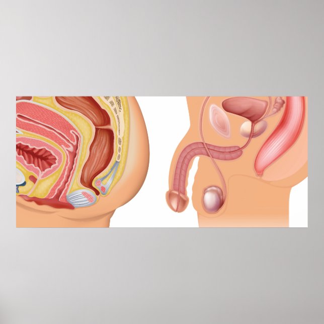 Affiche Système de réduction pour les femmes et les hommes (Devant)