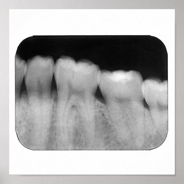 Affiche Teintures avec remplissage (Devant)