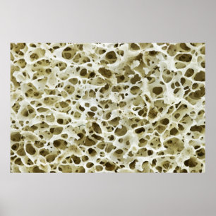 Affiche Texture poreuse magnétisée de l'os hanche humain