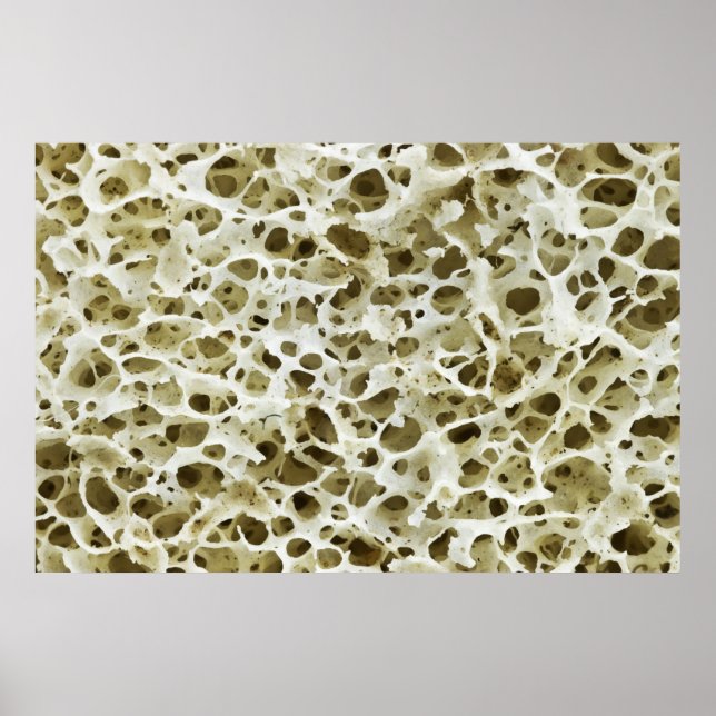 Affiche Texture poreuse magnétisée de l'os hanche humain (Devant)
