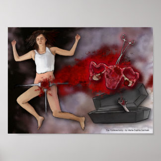 Affiche The Hysterectomy