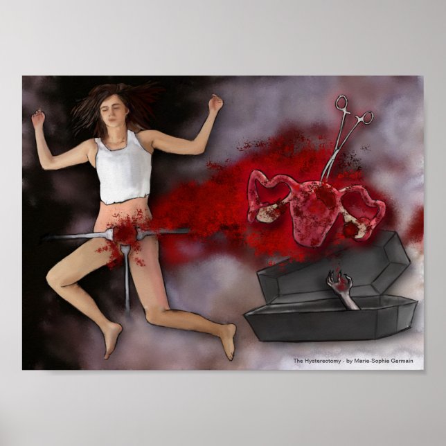 Affiche The Hysterectomy (Devant)