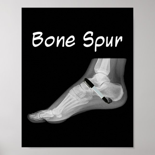 Affiche Trump Bone Spur Ink Pen Funny Anti Trump  (Devant)