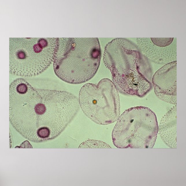 Affiche Volvox, algues (Devant)