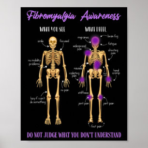 Affiche Vous Voyez Ce Que Je Ressens Squelette Fibromyalgi