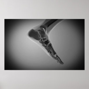 Affiche Vue En Rayon X Du Pied Humain 4