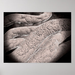 Affiche Vue microscopique de formation de Corncob