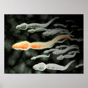 Affiche Vue Microscopique De Sperm Voyageant