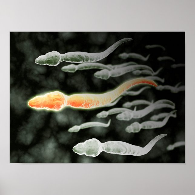 Affiche Vue Microscopique De Sperm Voyageant (Devant)