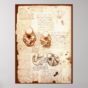 Affiche Vues d'un foetus dans l'utérus, Ob-Gyn Médicale
