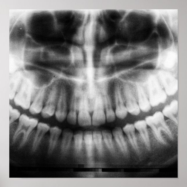 Affiche X-Ray Teeth Bouche sourire noir et blanc (Devant)