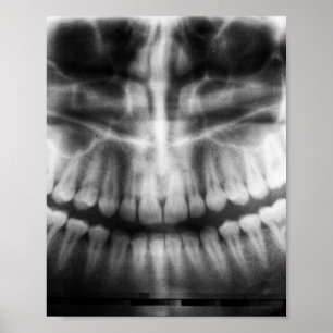 Affiche X-Ray Teeth Bouche sourire noir et blanc