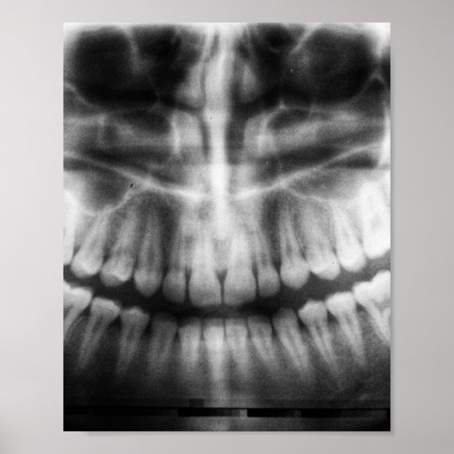 Affiche X-Ray Teeth Bouche sourire noir et blanc (Devant)